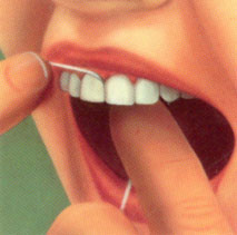 Очищення проміжків між зубами з допомогою зубних ниток